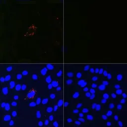 Anti-LC3B antibody [GT1187] used in Immunocytochemistry/ Immunofluorescence (ICC/IF). GTX00949