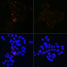 Anti-LC3B antibody [GT1187] used in Immunocytochemistry/ Immunofluorescence (ICC/IF). GTX00949