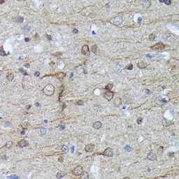 Anti-LC3B antibody [GT1187] used in IHC (Paraffin sections) (IHC-P). GTX00949