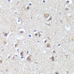 Anti-LC3B antibody [GT1187] used in IHC (Paraffin sections) (IHC-P). GTX00949