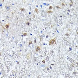 Anti-LC3B antibody [GT1187] used in IHC (Paraffin sections) (IHC-P). GTX00949