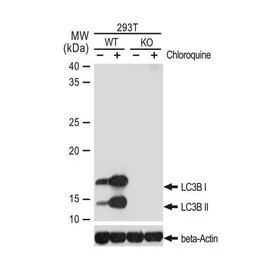 Anti-LC3B antibody [GT1187] used in Western Blot (WB). GTX00949