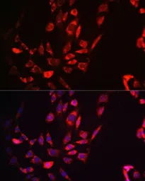 Anti-FIS1 antibody [GT1188] used in Immunocytochemistry/ Immunofluorescence (ICC/IF). GTX00950