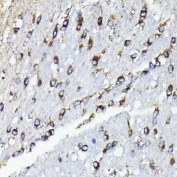 Anti-FIS1 antibody [GT1188] used in IHC (Paraffin sections) (IHC-P). GTX00950