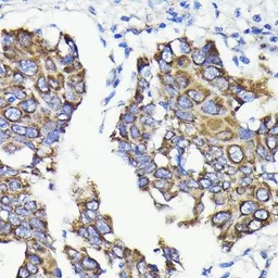 Anti-FIS1 antibody [GT1188] used in IHC (Paraffin sections) (IHC-P). GTX00950