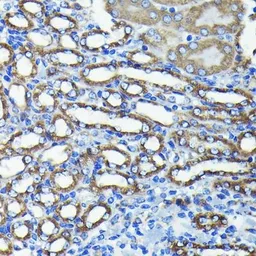 Anti-FIS1 antibody [GT1188] used in IHC (Paraffin sections) (IHC-P). GTX00950