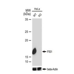 Anti-FIS1 antibody [GT1188] used in Western Blot (WB). GTX00950