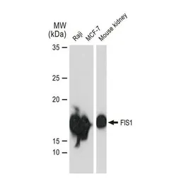 Anti-FIS1 antibody [GT1188] used in Western Blot (WB). GTX00950