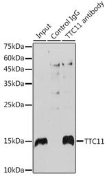 Anti-FIS1 antibody [GT1188] used in Immunoprecipitation (IP). GTX00950