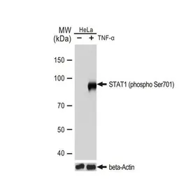 Anti-STAT1 (phospho Tyr701) antibody [GT1197] used in Western Blot (WB). GTX00959