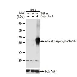 Anti-eIF2 alpha (phospho Ser51) antibody [GT1203] used in Western Blot (WB). GTX00965