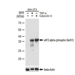 Anti-eIF2 alpha (phospho Ser51) antibody [GT1203] used in Western Blot (WB). GTX00965