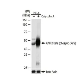 Anti-GSK3 beta (phospho Ser9) antibody [GT1209] used in Western Blot (WB). GTX00971