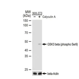 Anti-GSK3 beta (phospho Ser9) antibody [GT1209] used in Western Blot (WB). GTX00971