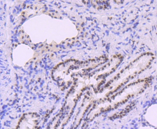 Anti-DNA polymerase beta antibody [JM93-12] used in IHC (Paraffin sections) (IHC-P). GTX00983