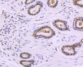 Anti-DNA polymerase beta antibody [JM93-12] used in IHC (Paraffin sections) (IHC-P). GTX00983