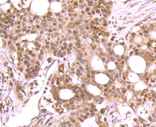 Anti-DNA polymerase beta antibody [JM93-12] used in IHC (Paraffin sections) (IHC-P). GTX00983