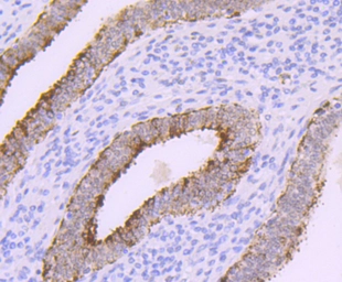 Anti-DNA polymerase beta antibody [JM93-12] used in IHC (Paraffin sections) (IHC-P). GTX00983