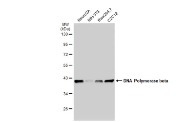 Anti-DNA polymerase beta antibody [JM93-12] used in Western Blot (WB). GTX00983