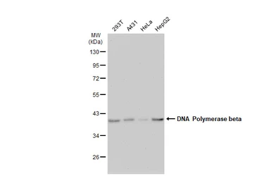 Anti-DNA polymerase beta antibody [JM93-12] used in Western Blot (WB). GTX00983