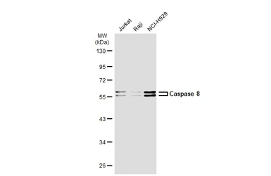 Anti-Caspase 8 antibody [GT1152] used in Western Blot (WB). GTX01015