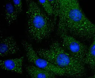 Anti-ILK antibody [SC68-04] used in Immunocytochemistry/ Immunofluorescence (ICC/IF). GTX01046