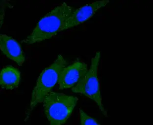 Anti-ILK antibody [SC68-04] used in Immunocytochemistry/ Immunofluorescence (ICC/IF). GTX01046