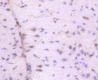 Anti-ILK antibody [SC68-04] used in IHC (Paraffin sections) (IHC-P). GTX01046