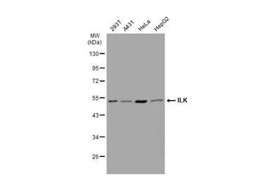 Anti-ILK antibody [SC68-04] used in Western Blot (WB). GTX01046