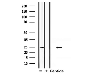 Anti-Claudin 10 antibody used in Western Blot (WB). GTX01076