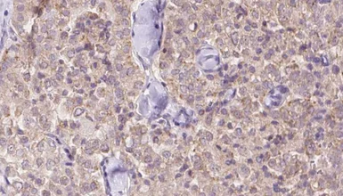 Anti-USP9X antibody used in IHC (Paraffin sections) (IHC-P). GTX01079