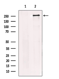 Anti-USP9X antibody used in Western Blot (WB). GTX01079