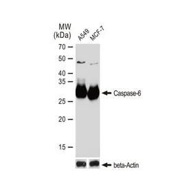 Anti-Caspase 6 antibody [GT1154] used in Western Blot (WB). GTX01097