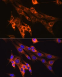 Anti-Caspase 6 antibody [GT1155] used in Immunocytochemistry/ Immunofluorescence (ICC/IF). GTX01098