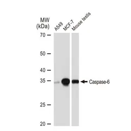 Anti-Caspase 6 antibody [GT1155] used in Western Blot (WB). GTX01098