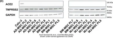 Anti-ACE2 antibody [SN0754] used in Western Blot (WB). GTX01160