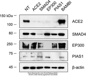 Anti-ACE2 antibody [SN0754] used in Western Blot (WB). GTX01160