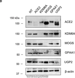 Anti-ACE2 antibody [SN0754] used in Western Blot (WB). GTX01160