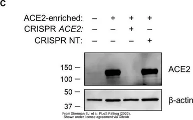 Anti-ACE2 antibody [SN0754] used in Western Blot (WB). GTX01160