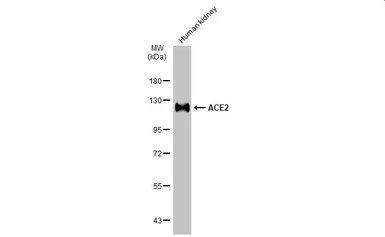 Anti-ACE2 antibody [SN0754] used in Western Blot (WB). GTX01160