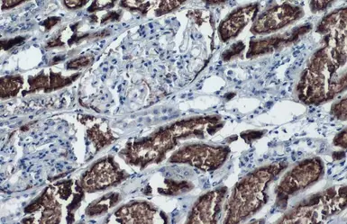 Anti-ACE2 antibody [SN0754] used in IHC (Paraffin sections) (IHC-P). GTX01160