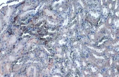 Anti-ACE2 antibody [SN0754] used in IHC (Paraffin sections) (IHC-P). GTX01160