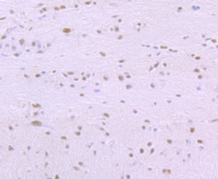 Anti-SF3B1 antibody [JB40-32] used in IHC (Paraffin sections) (IHC-P). GTX01165