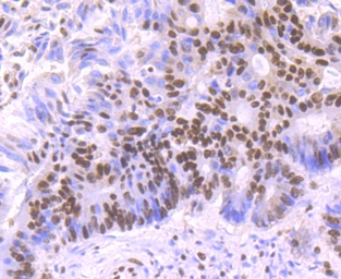 Anti-SF3B1 antibody [JB40-32] used in IHC (Paraffin sections) (IHC-P). GTX01165