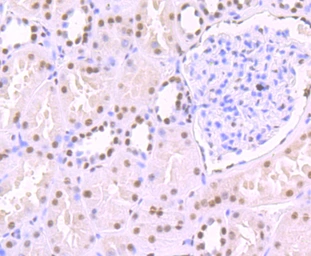 Anti-SF3B1 antibody [JB40-32] used in IHC (Paraffin sections) (IHC-P). GTX01165