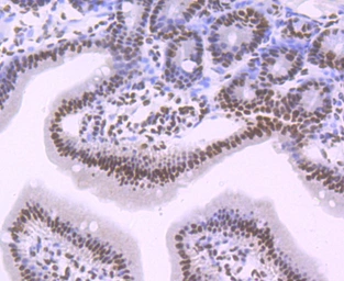 Anti-SF3B1 antibody [JB40-32] used in IHC (Paraffin sections) (IHC-P). GTX01165