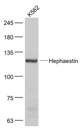 Anti-Hephaestin antibody used in Western Blot (WB). GTX01178