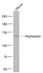 Anti-Hephaestin antibody used in Western Blot (WB). GTX01178