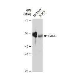 Anti-GATA3 antibody [GT1217] used in Western Blot (WB). GTX01198