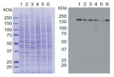 Anti-KDM5A / Jarid1A / RBBP2 antibody [9A6] used in Western Blot (WB). GTX01204